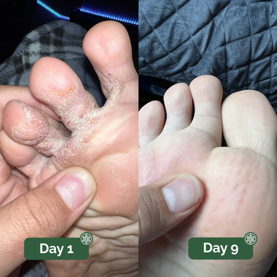 TerraFoot Antifungal Soap
