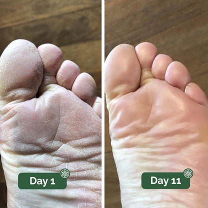 Clear Feet Start Here