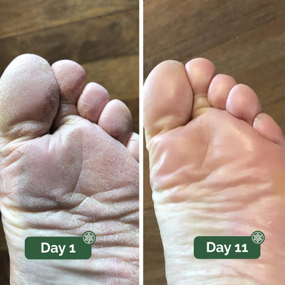 TerraFoot Antifungal Soap