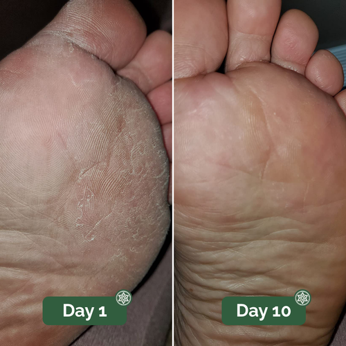 TerraFoot Antifungal Soap